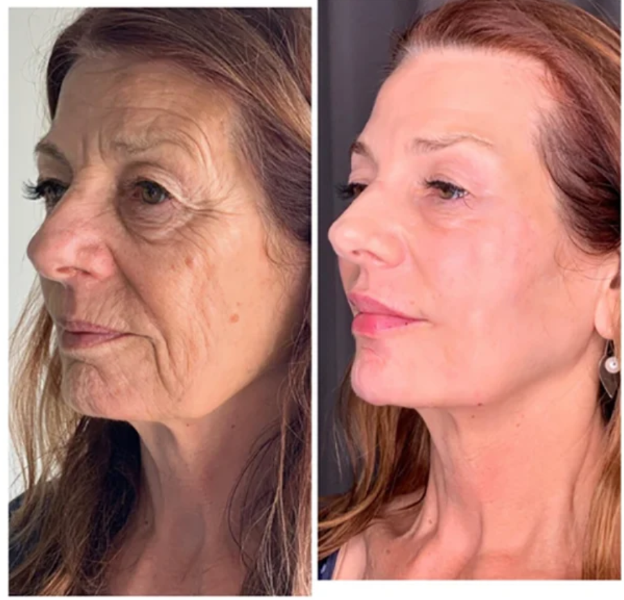 Pack (2 Bouteilles_) Sérum Collagen anti-âge Advanced Boost🔥